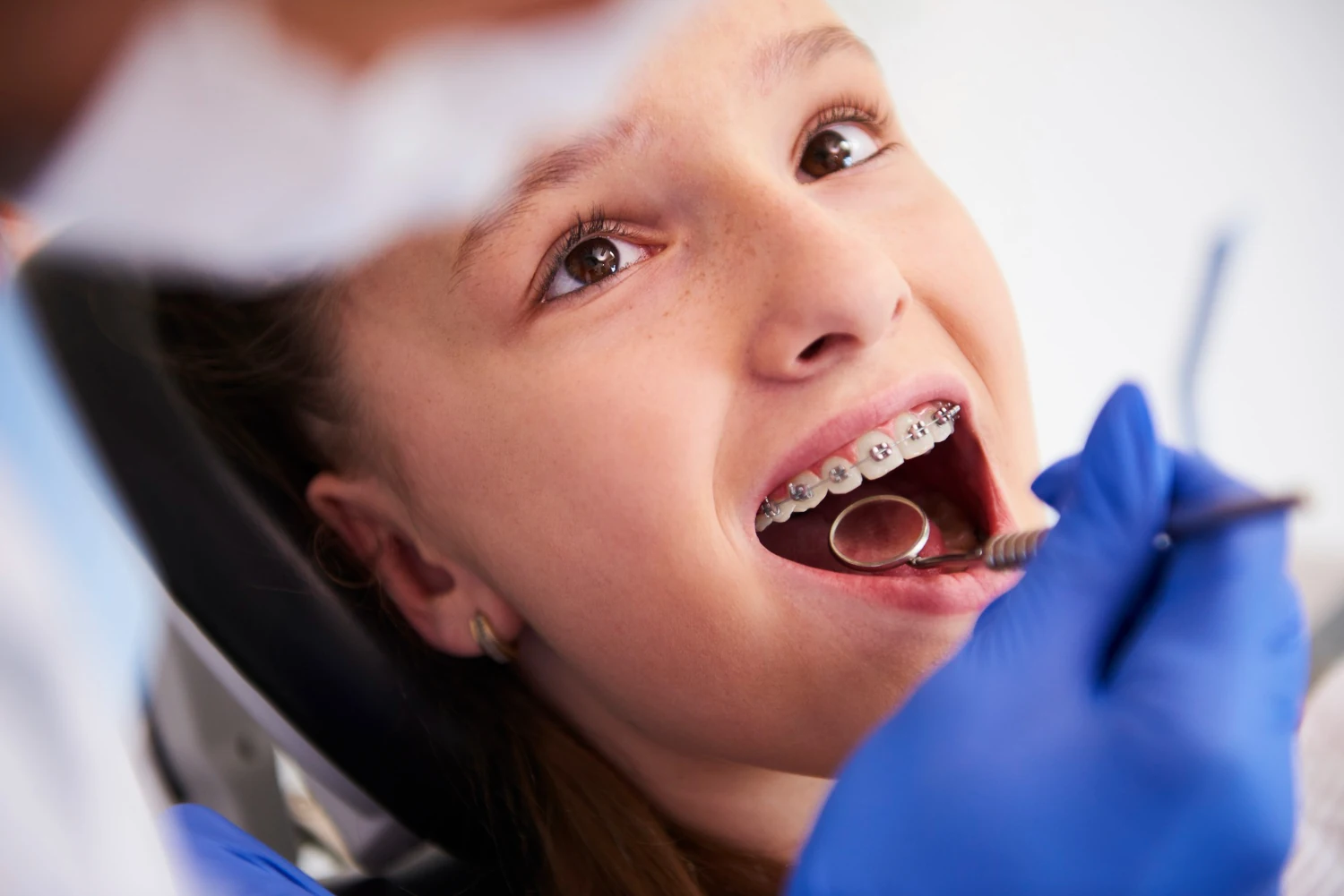 Orthodontie chez l’enfant : coût, prise en charge et remboursements
