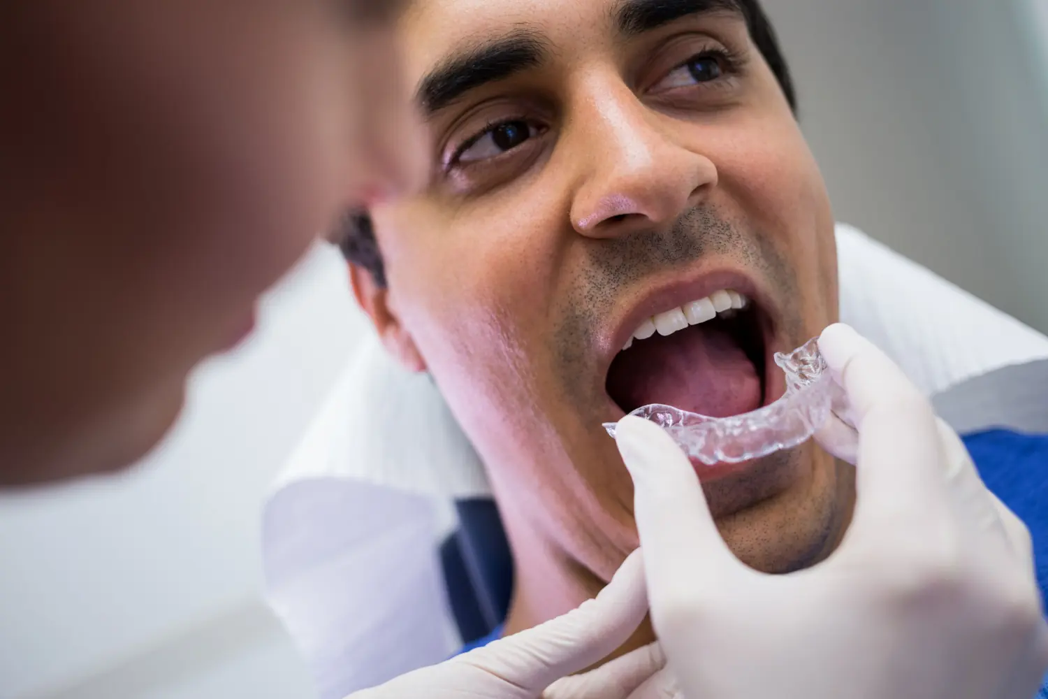 La prise en charge de l&rsquo;orthodontie chez l&rsquo;adulte